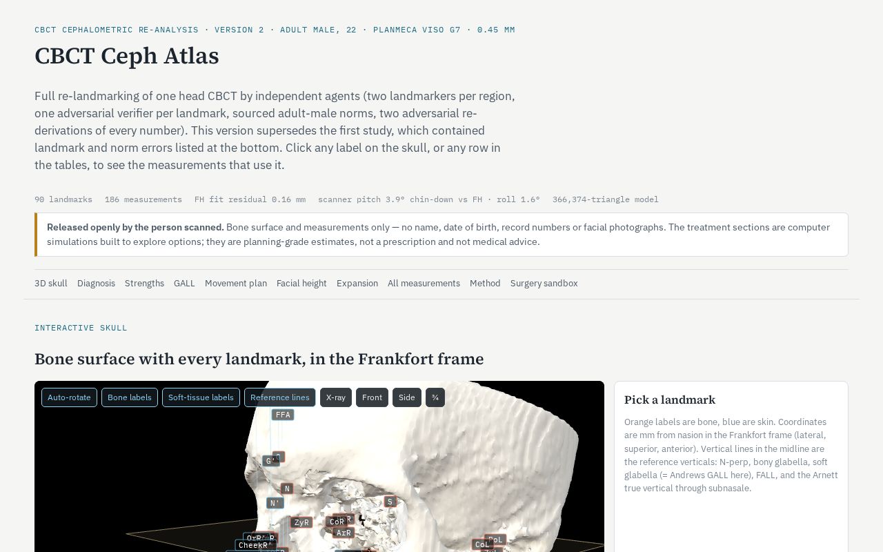 Preview of Cbct Ceph Atlas