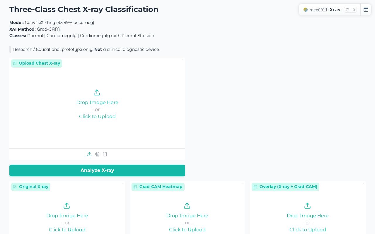 Preview of Xray