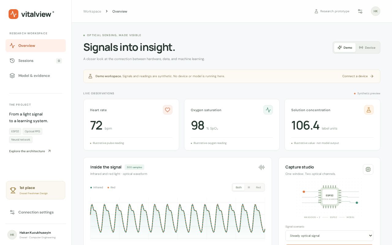 Preview of Vitalview