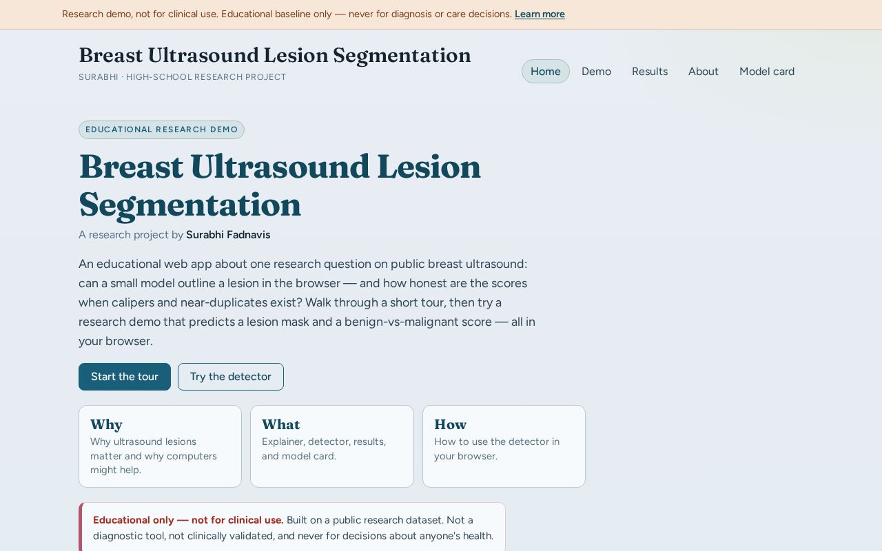 Preview of Breast Ultrasound Lesion Segmentation