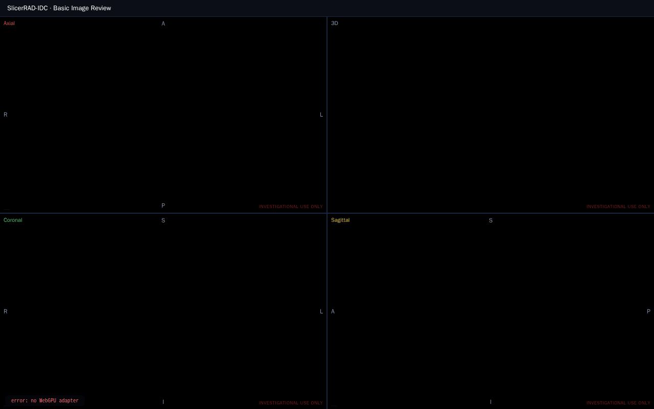 Preview of SlicerRAD IDC