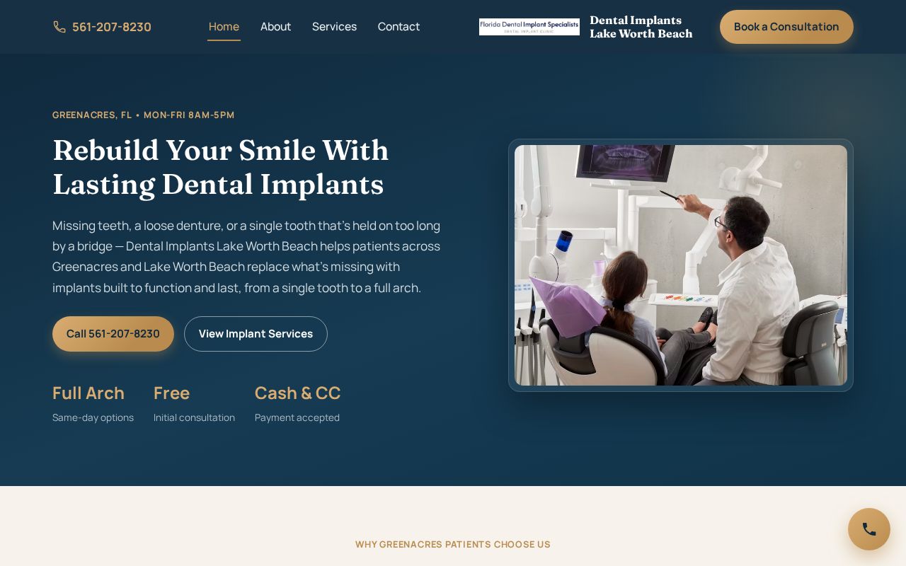 Preview of Long Lasting Dental Implants