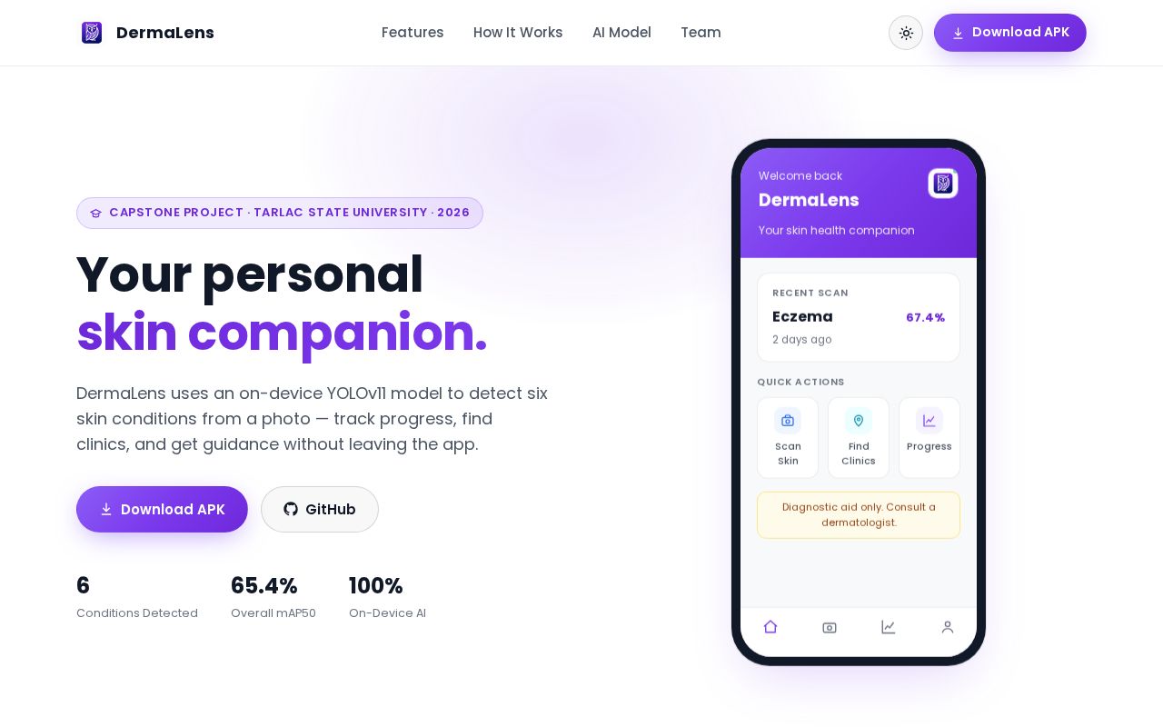 Preview of DermaLensLandingPage