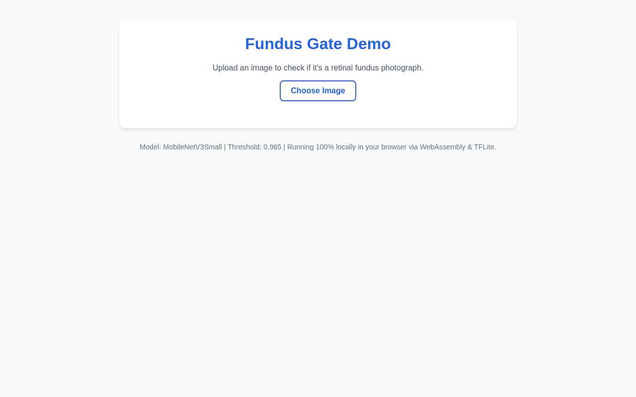 Preview of Fundus Gate