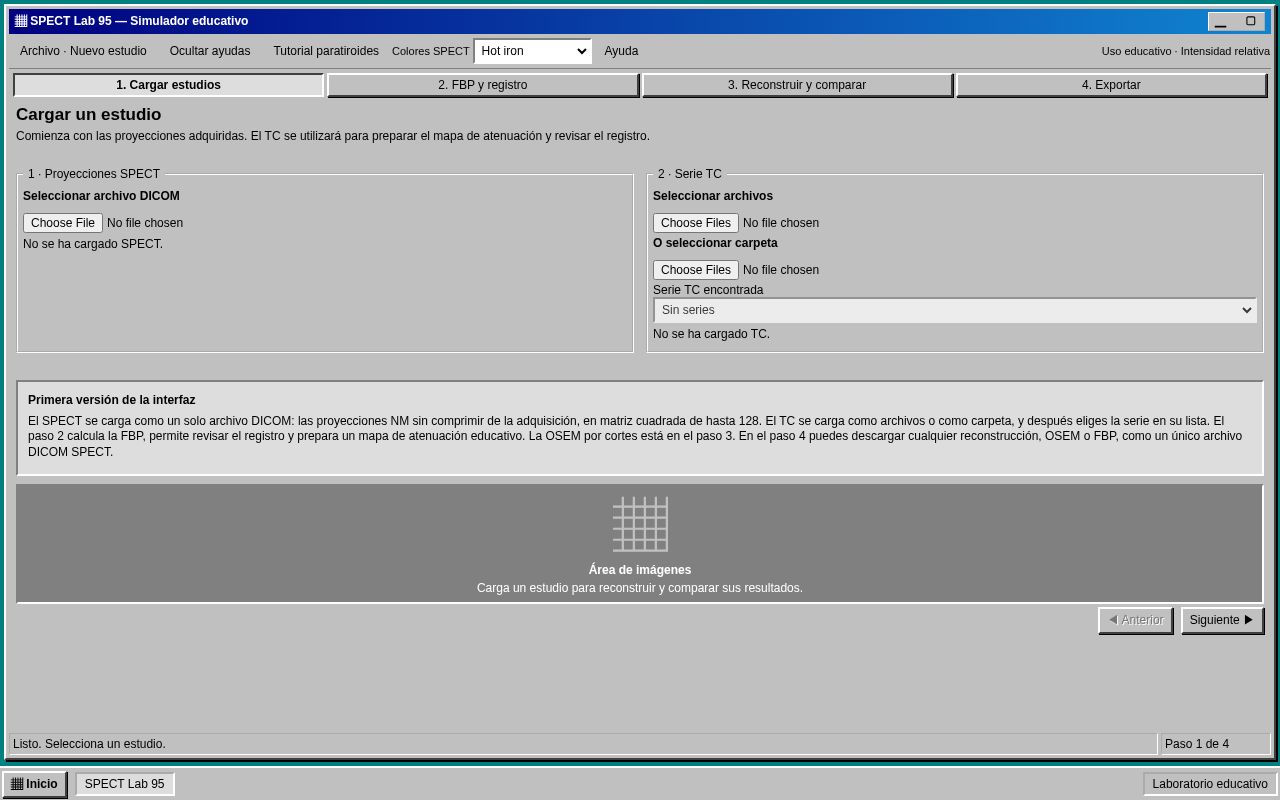 Preview of SPECT Lab 95