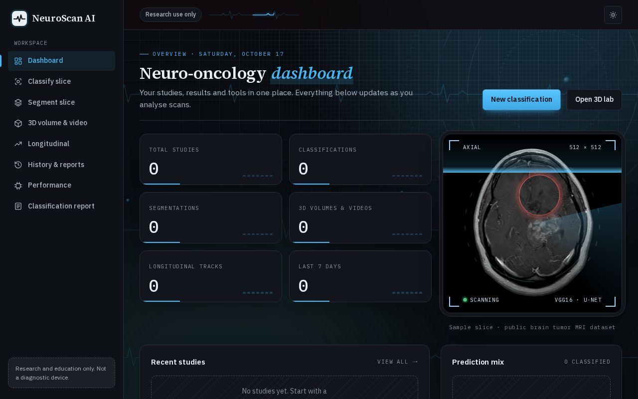 Preview of Longitudinal Brain Tumour Segmentation
