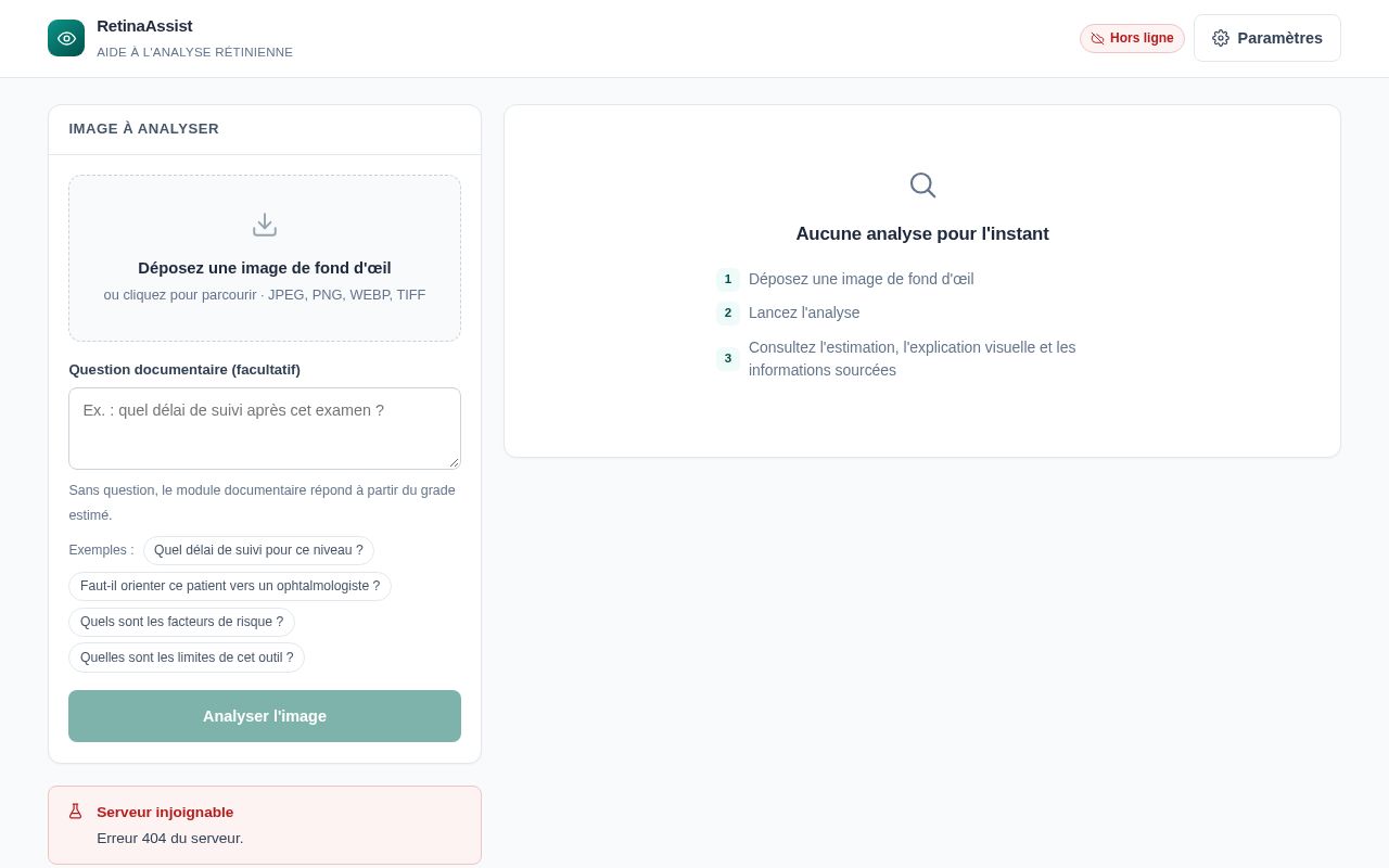 Preview of RetinaAssist