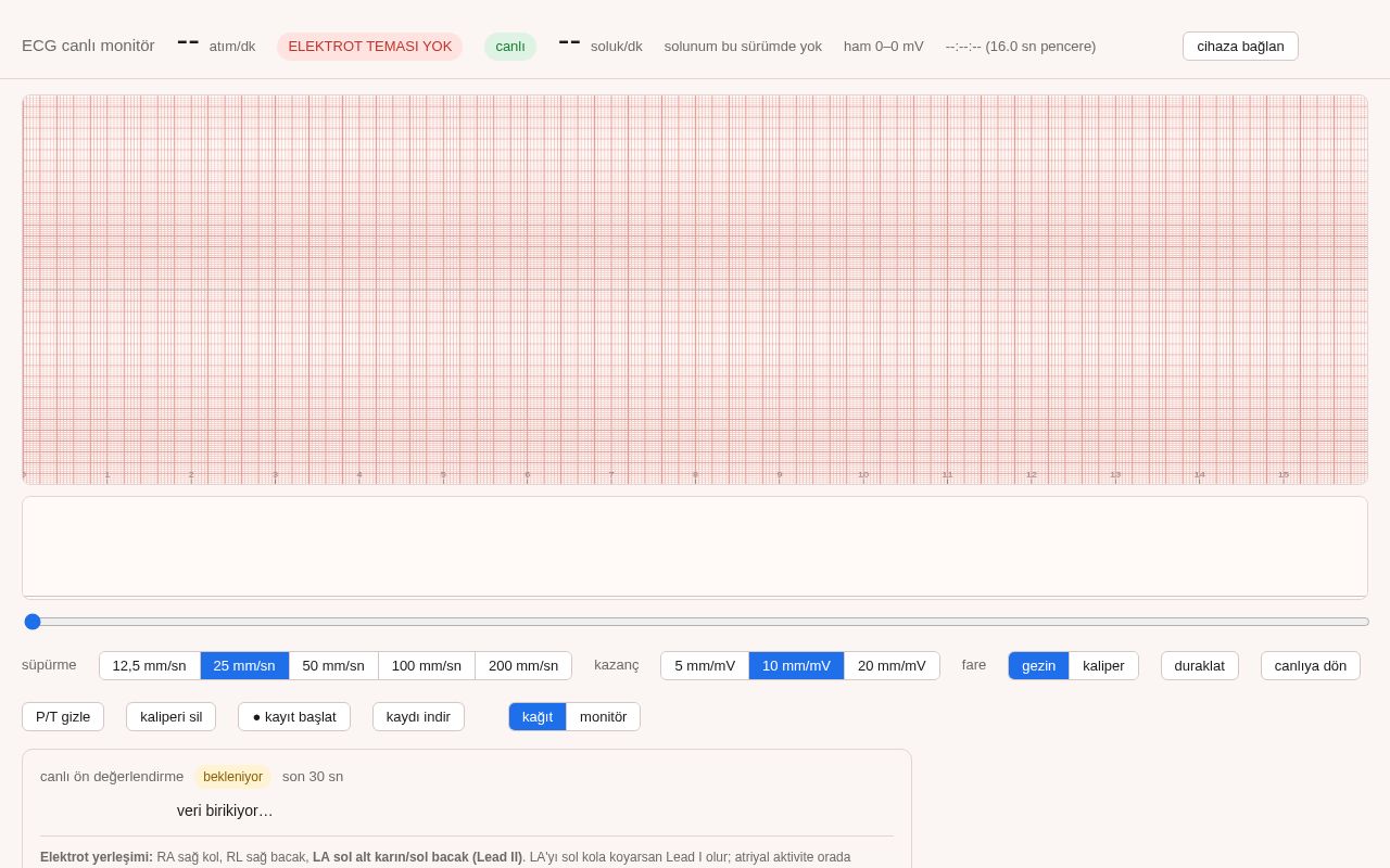 Preview of Ecg Ble