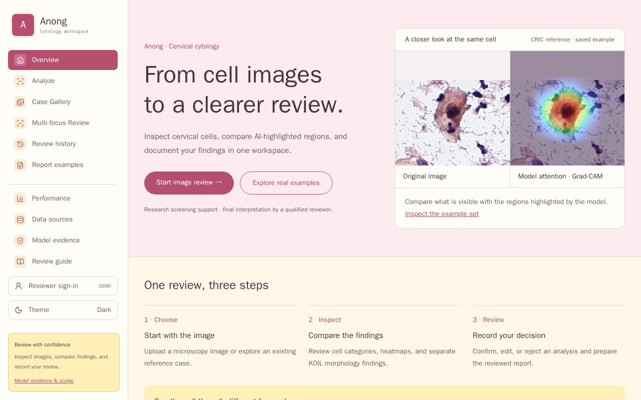 Preview of ANONG Web