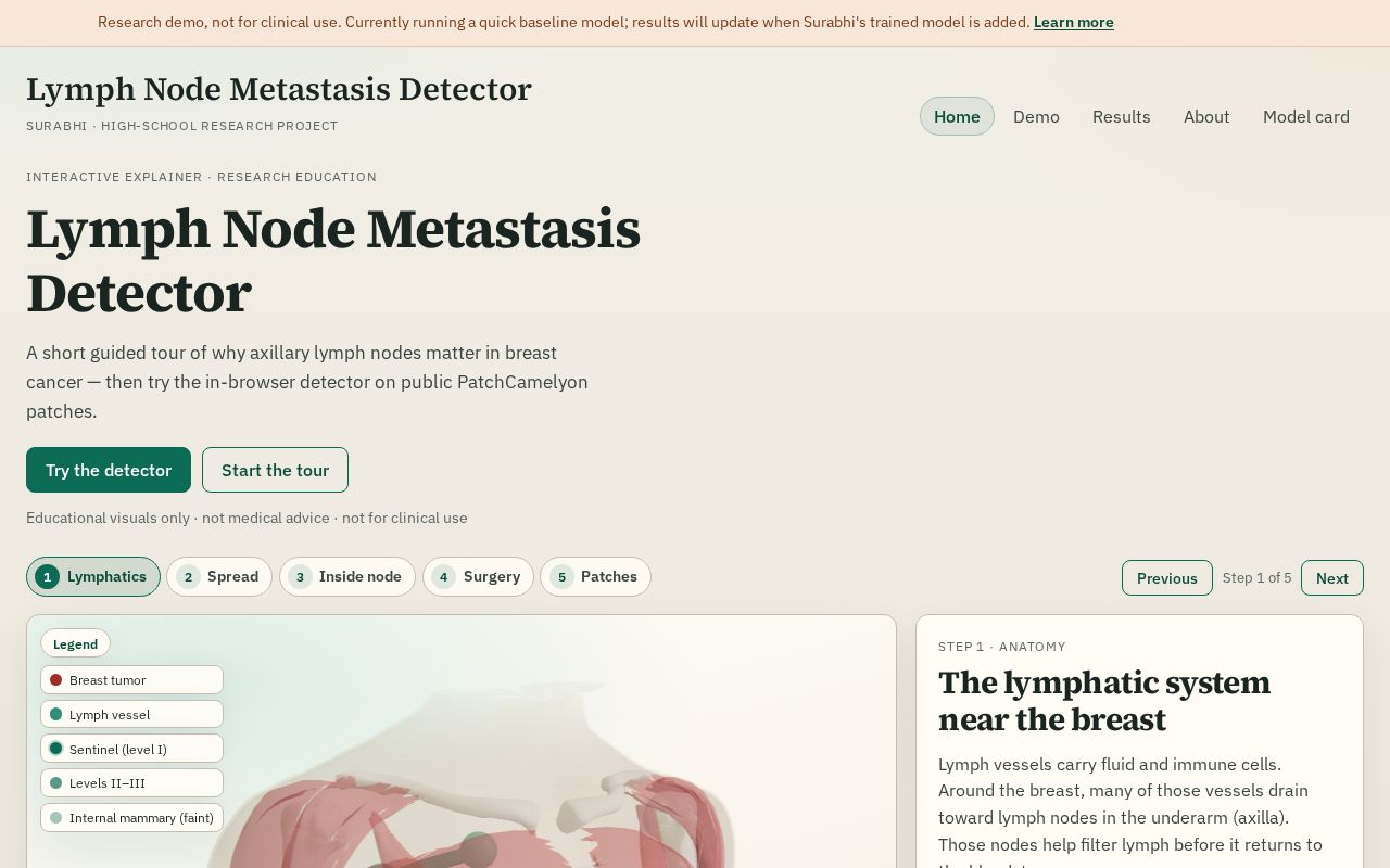 Preview of Lymph Node Metastasis Detector