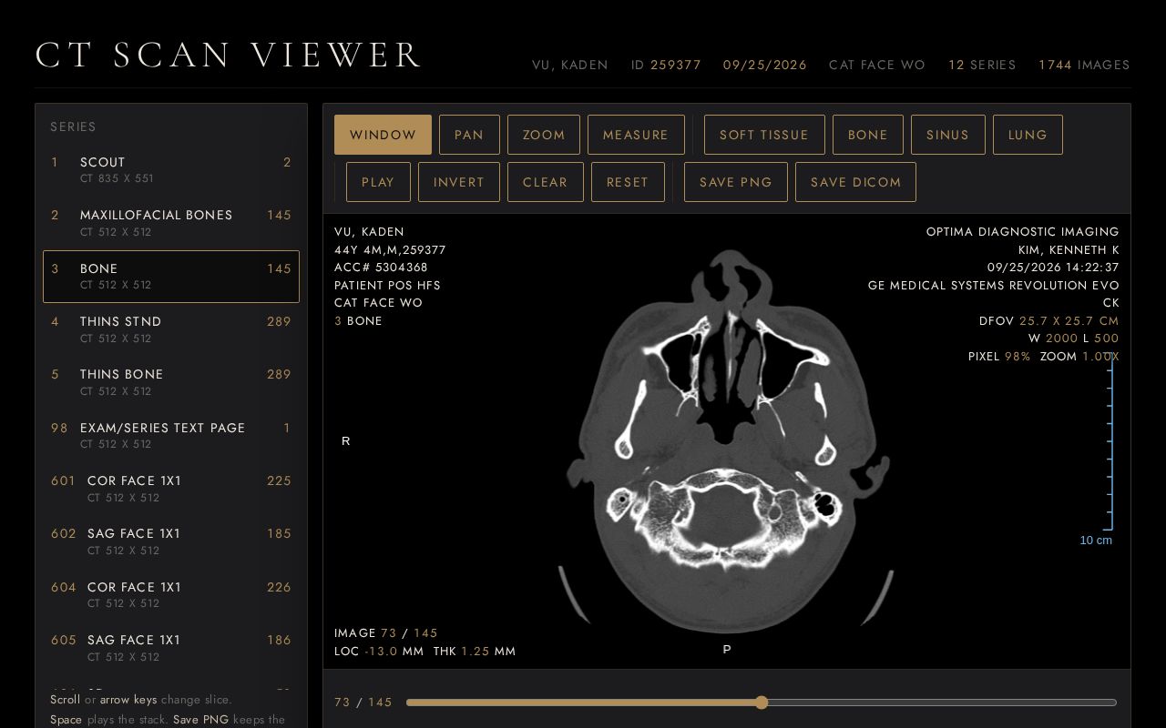 Preview of Kade Sinus CTscan