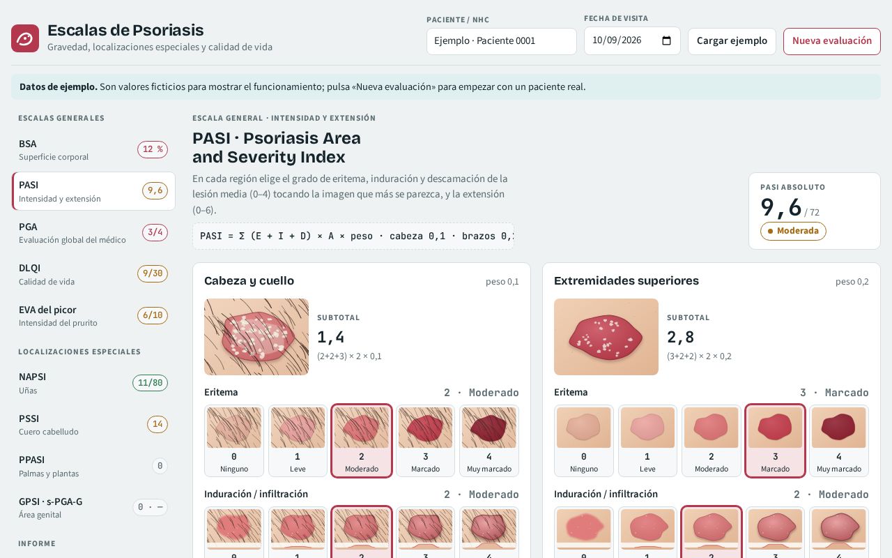 Preview of Escalas Psoriasis