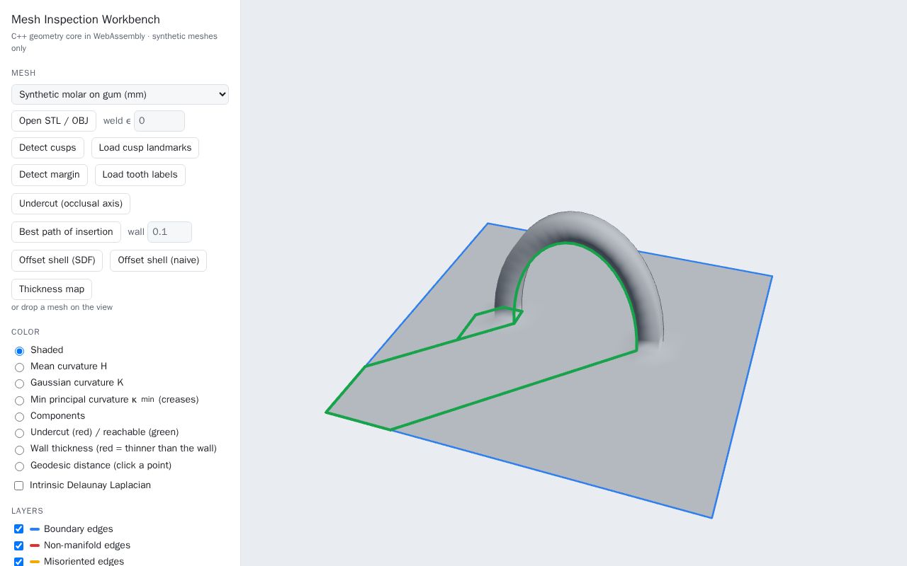 Preview of Dental Mesh Workbench