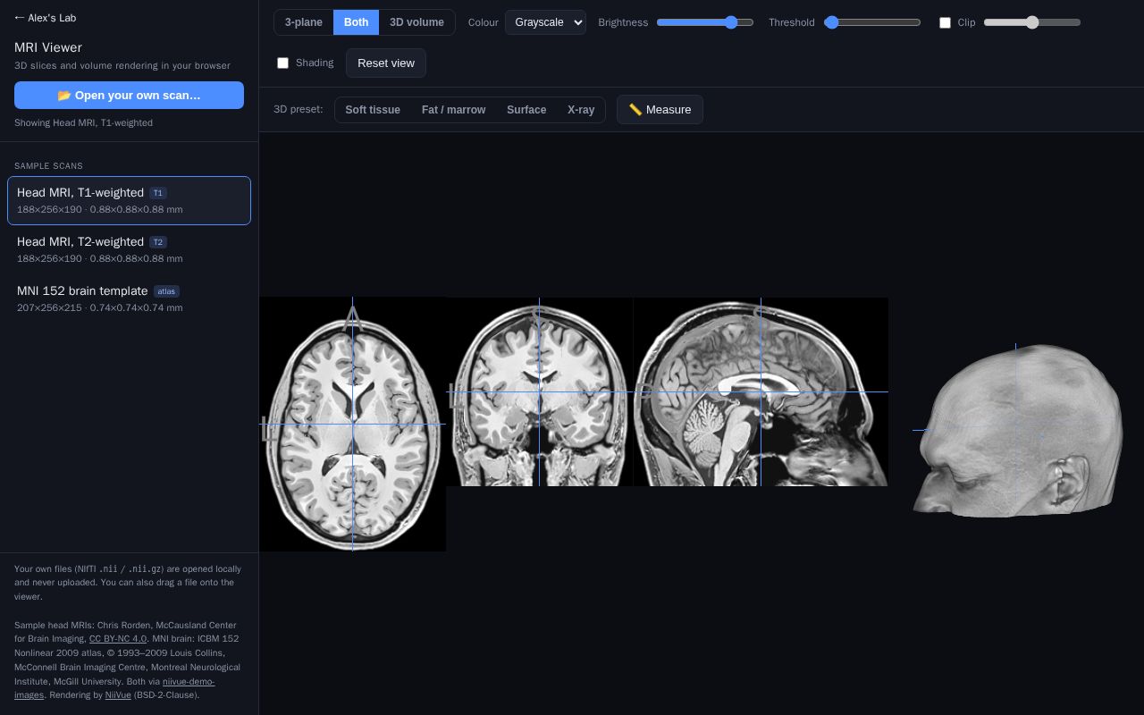 Preview of MRI Viewer