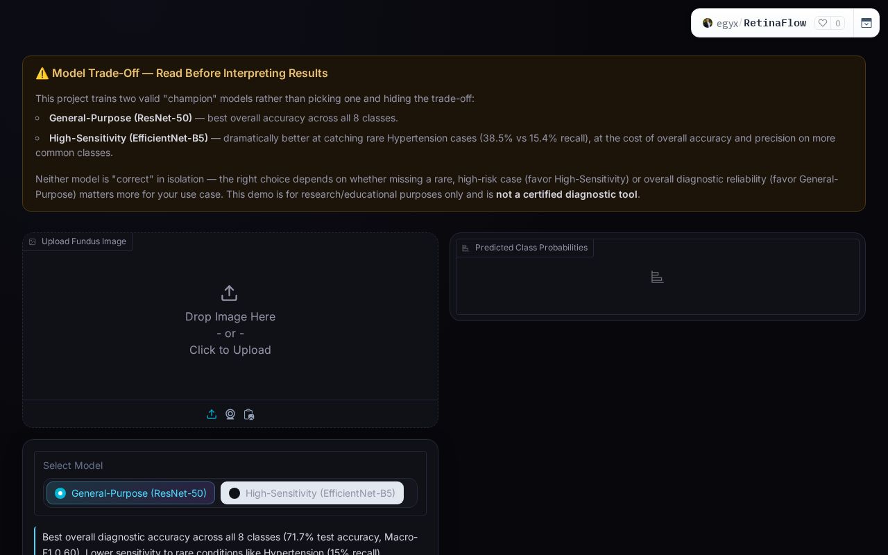Preview of RetinaFlow