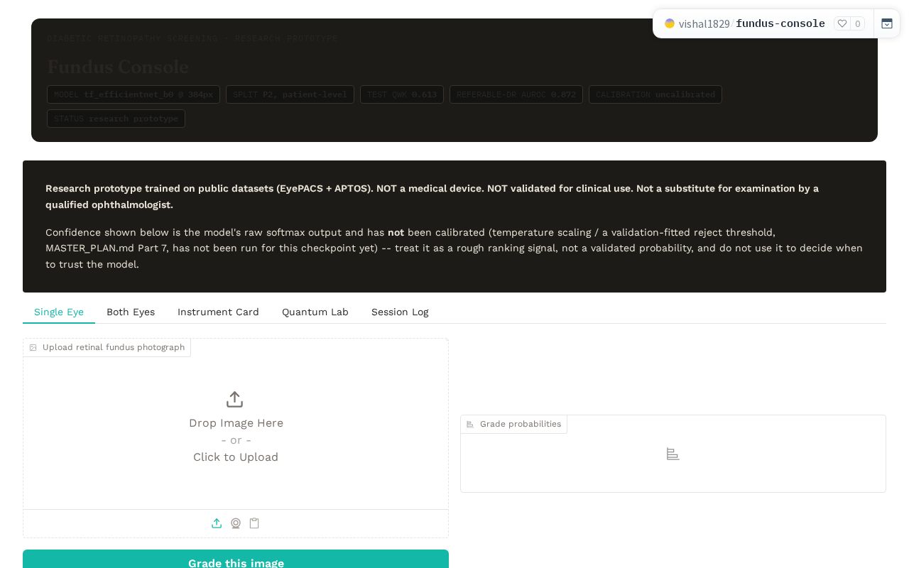 Preview of Fundus Console