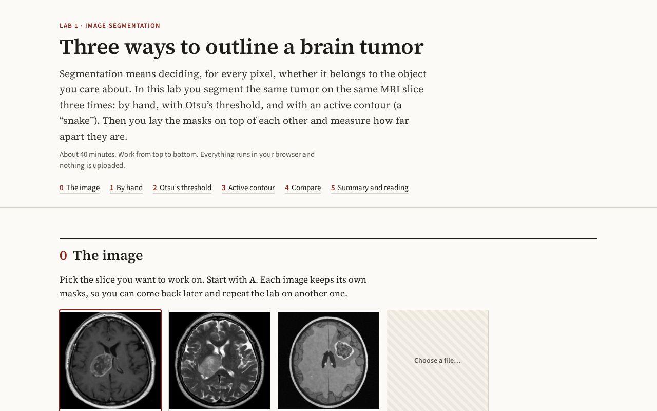 Preview of Tumor Segmentation Lab
