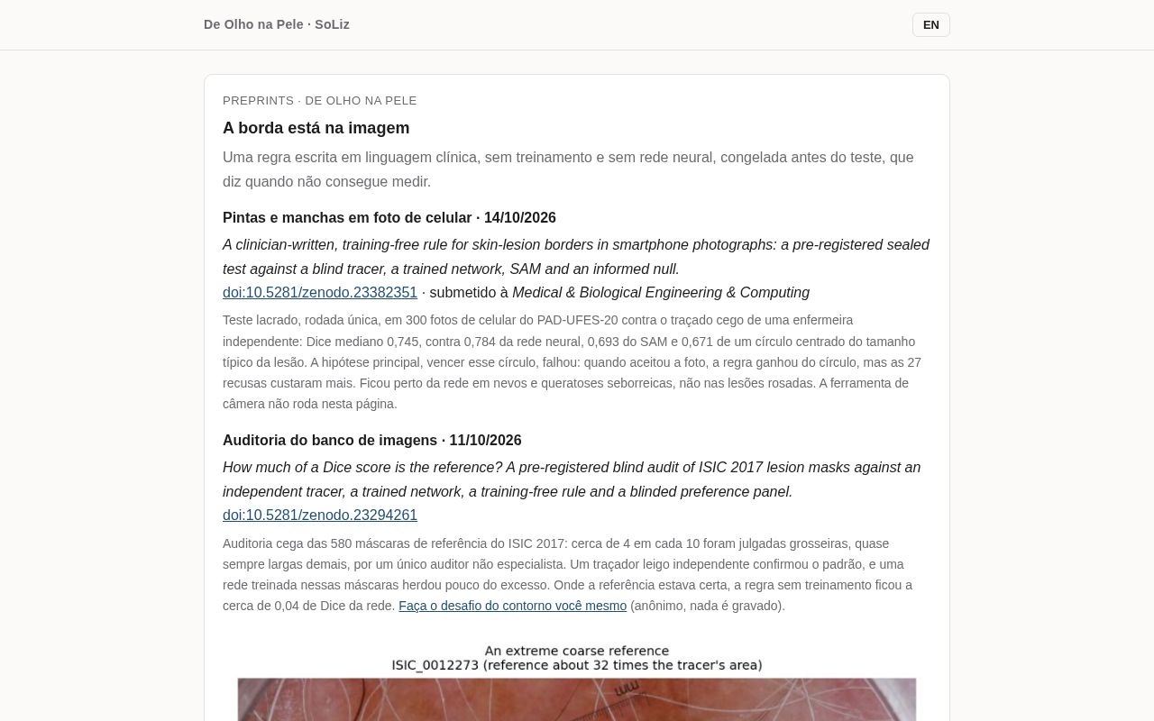 Preview of Deolhonapele