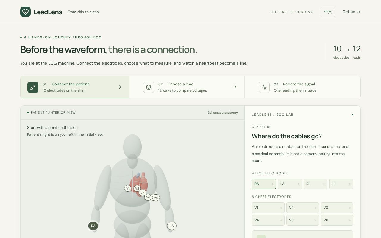 Preview of LeadLens