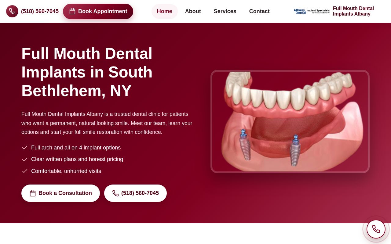 Preview of Full Mouth Dental Implants Albany