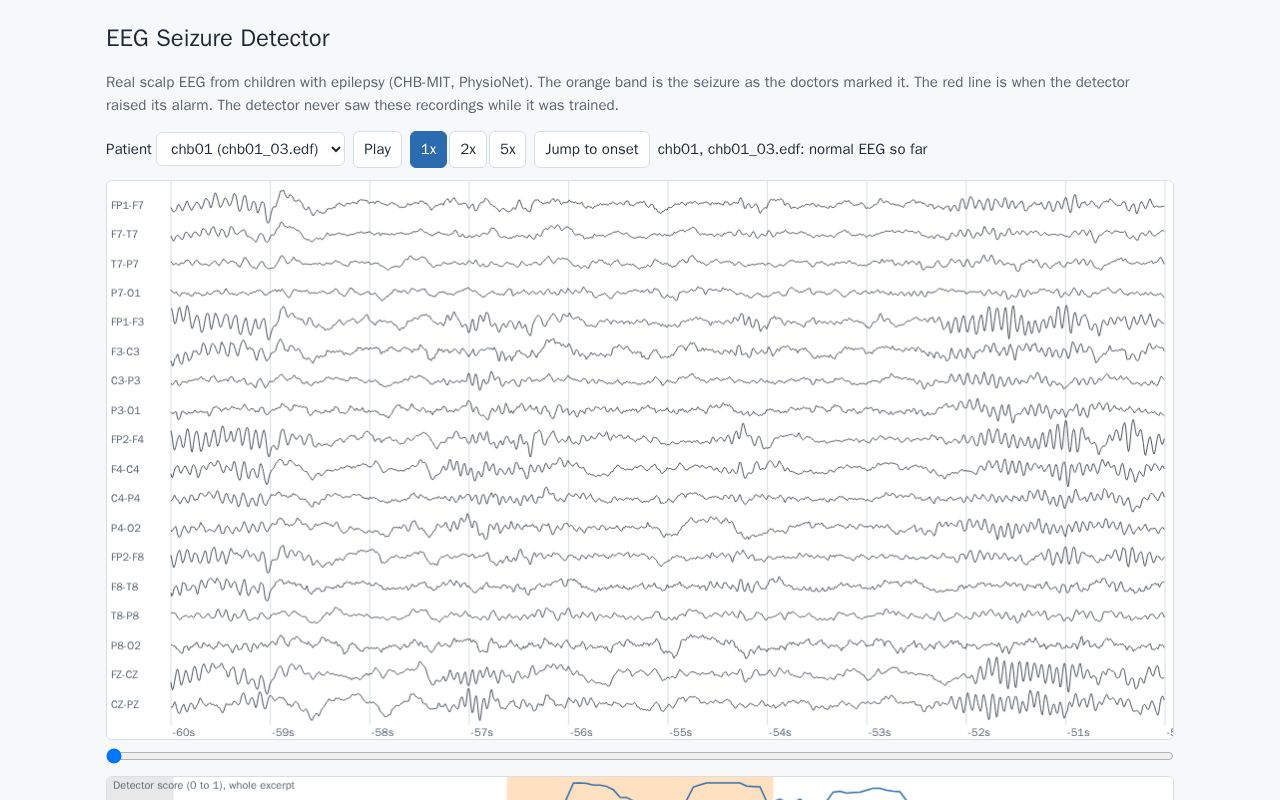 Preview of EEG Seizure Detection