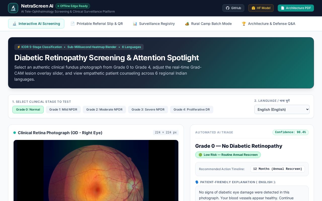 Preview of NetraScreen AI - Diabetic Retinopathy Screening