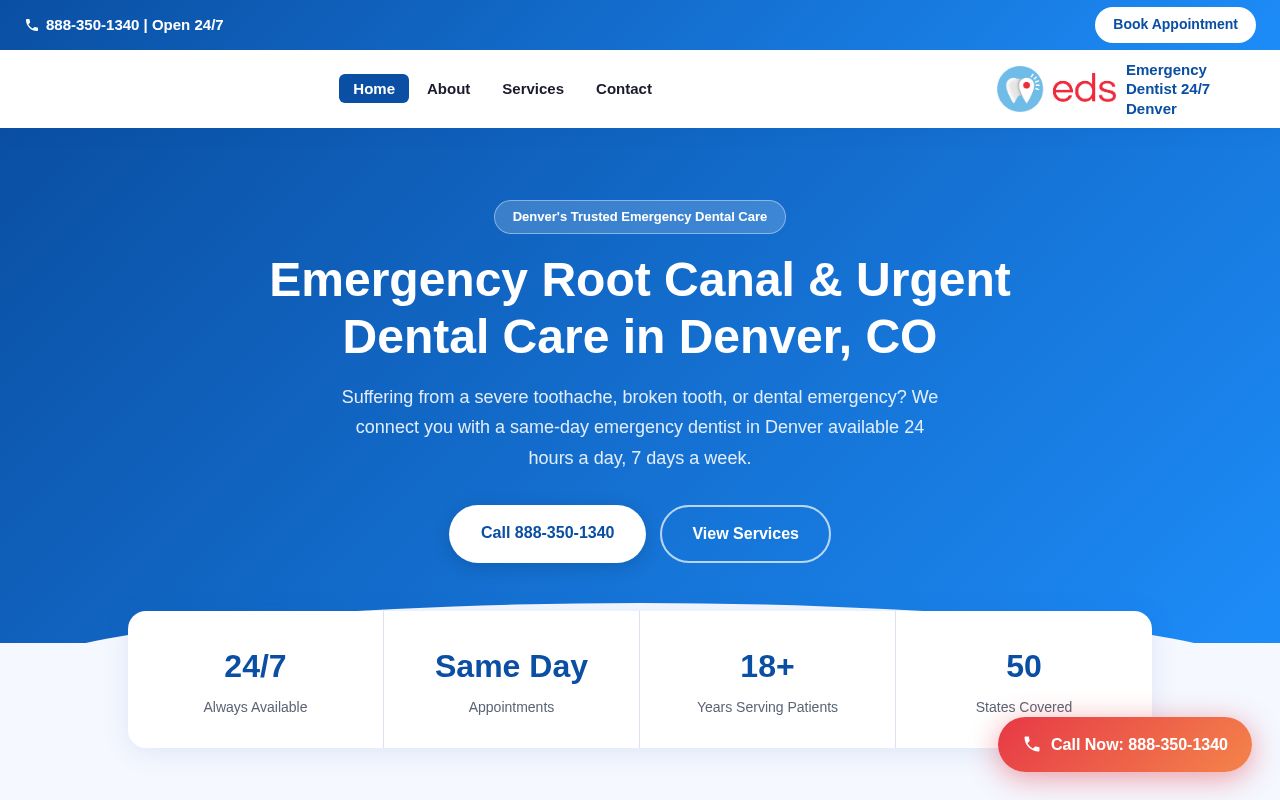 Preview of Emergency Root Canal